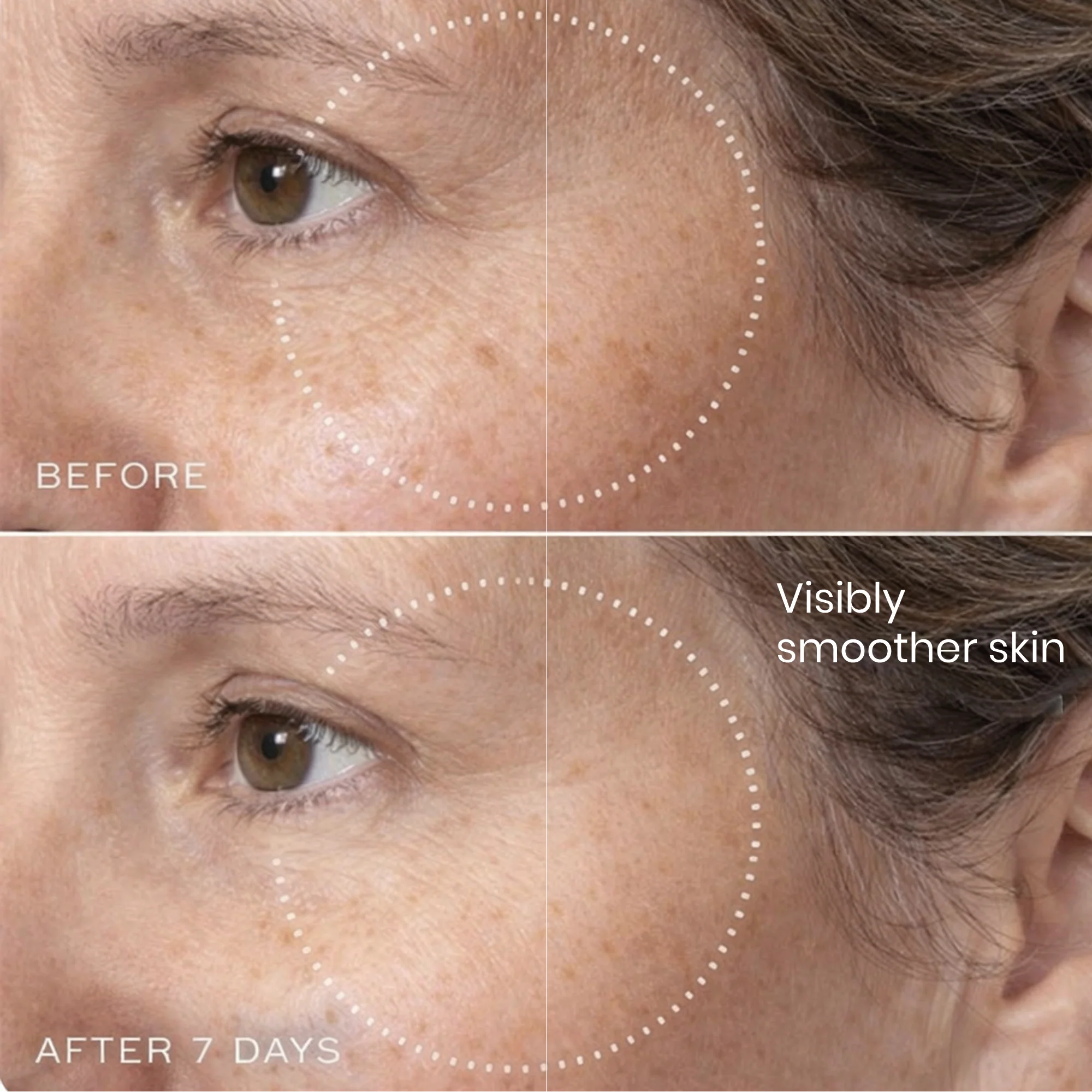 Brightr® Eye wrinkle smoothing patches - Image 3